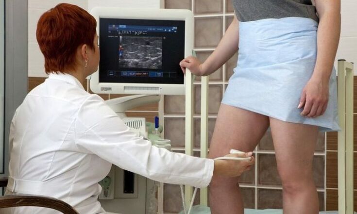 coagulación láser para o tratamento das varices