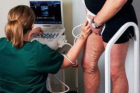 Opcións de diagnóstico para varices nas pernas