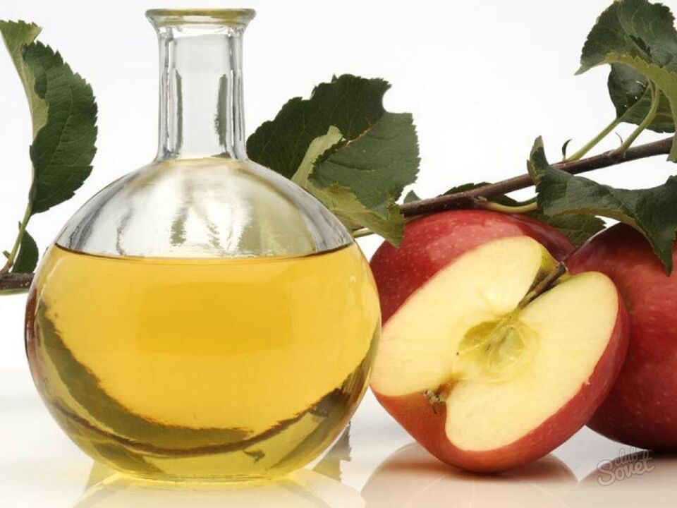 vinagre de mazá para varices